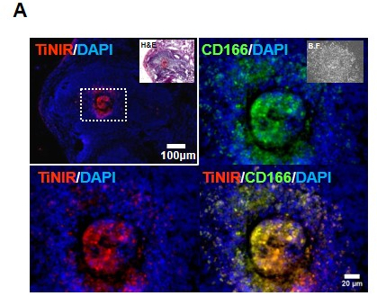 ▲ 종양이 유도된 생쥐의 폐에서 타이니어가 종양근원세포를 붉은색으로 물들였다. (사진 : IBS)